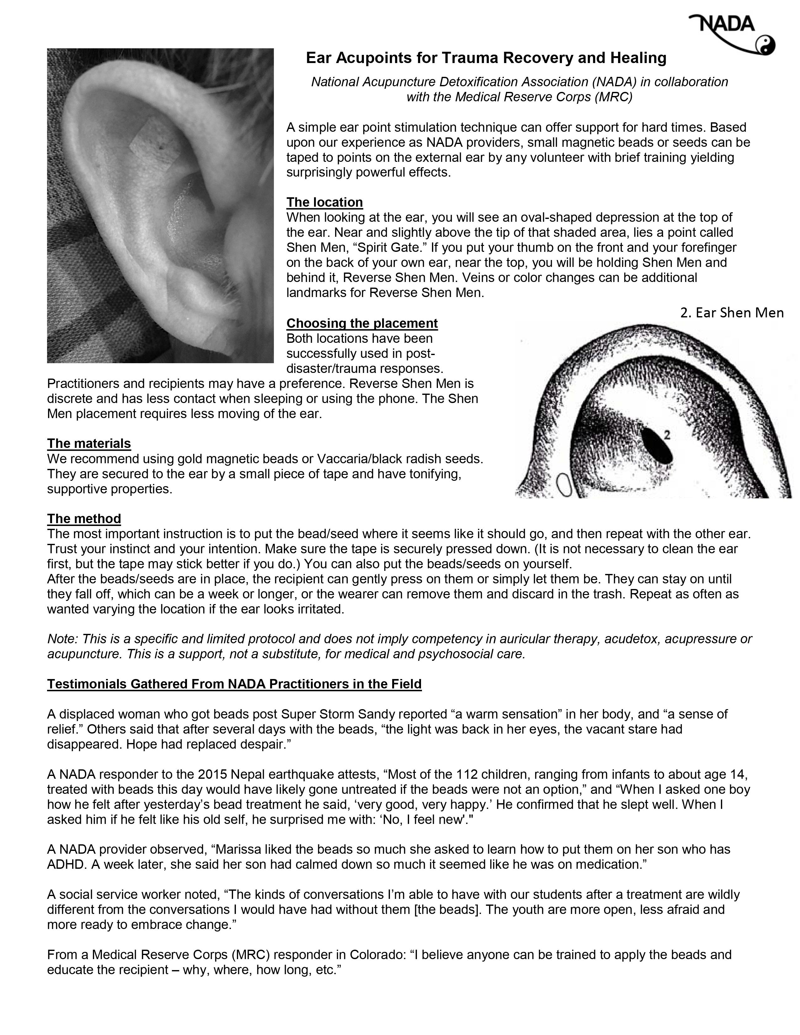 Ear Seeds Resources Manchester Acupuncture Studio